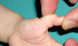 Tetik parmak-başparmak nedir?