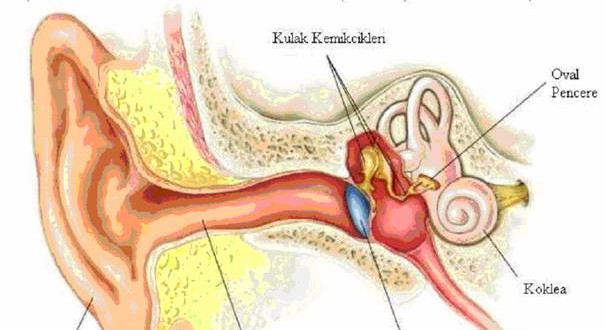 Orta Kulak İltihabı Belirtileri, Hızlı Tedavisi